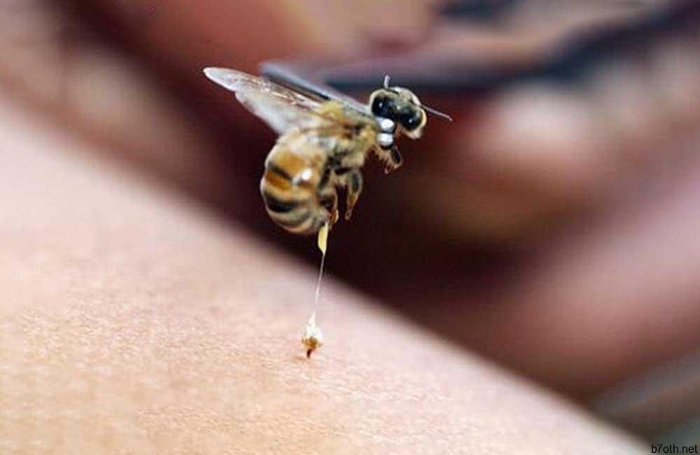 Bee Sting Facials @the_telegraph/Pinterest